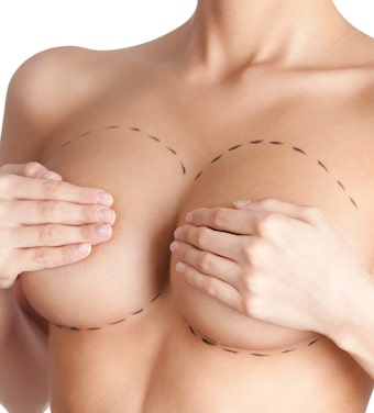 Celebrity Breast Surgery Options