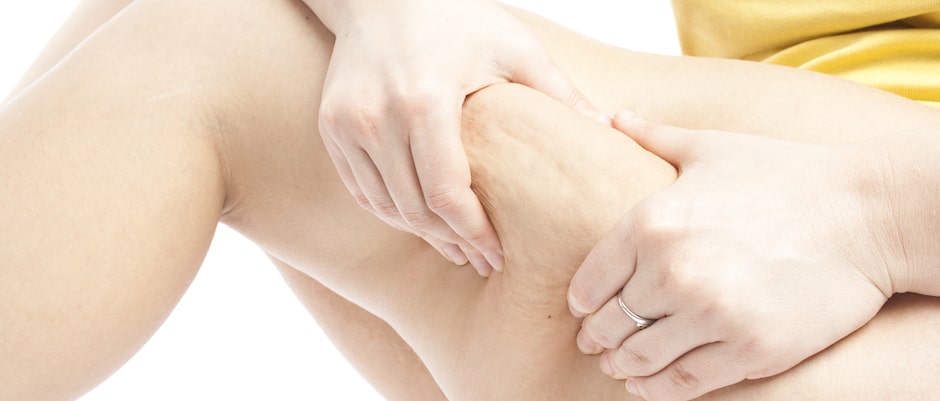 Qwo treatment is a non surgical option to treat cellulite