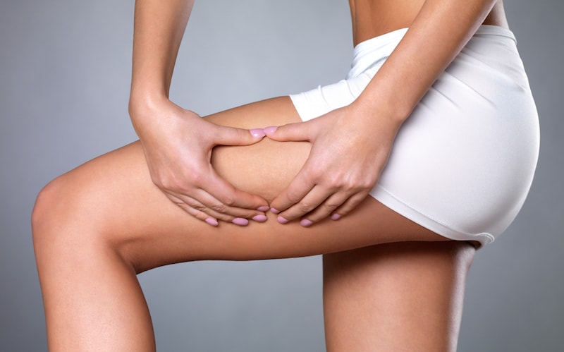 Cellulite reduction eliminates its appearance on the skin