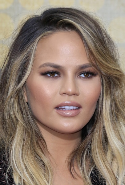 Chrissy Teigen had to shut down plastic surgery rumors