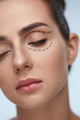 Cosmetic Eyelid Surgery – Blepharoplasty Explained