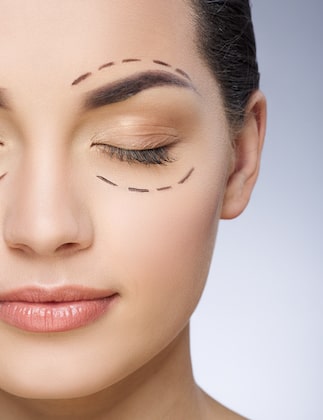 Eyelid Surgery with No Training