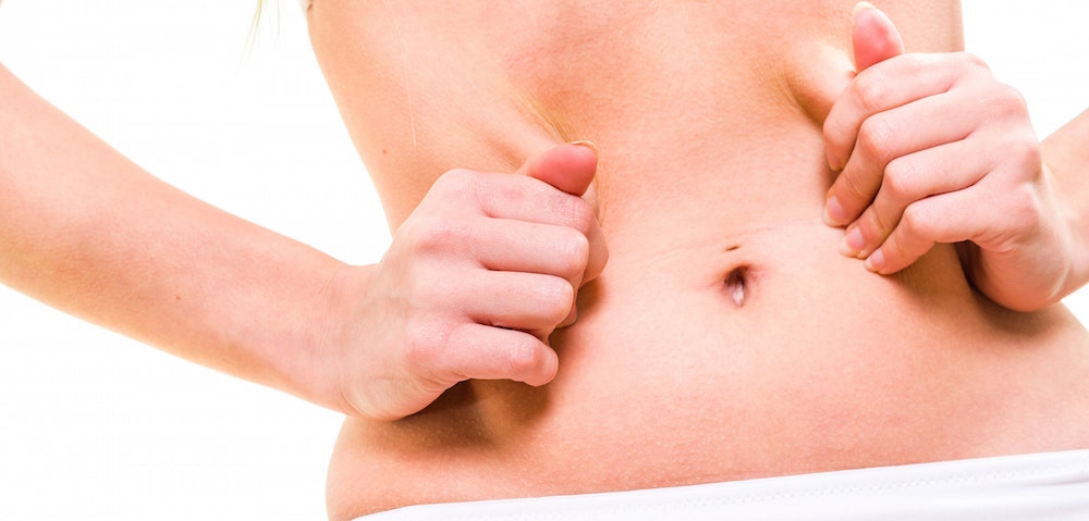 Liposuction - The facts you need to know before a procedure