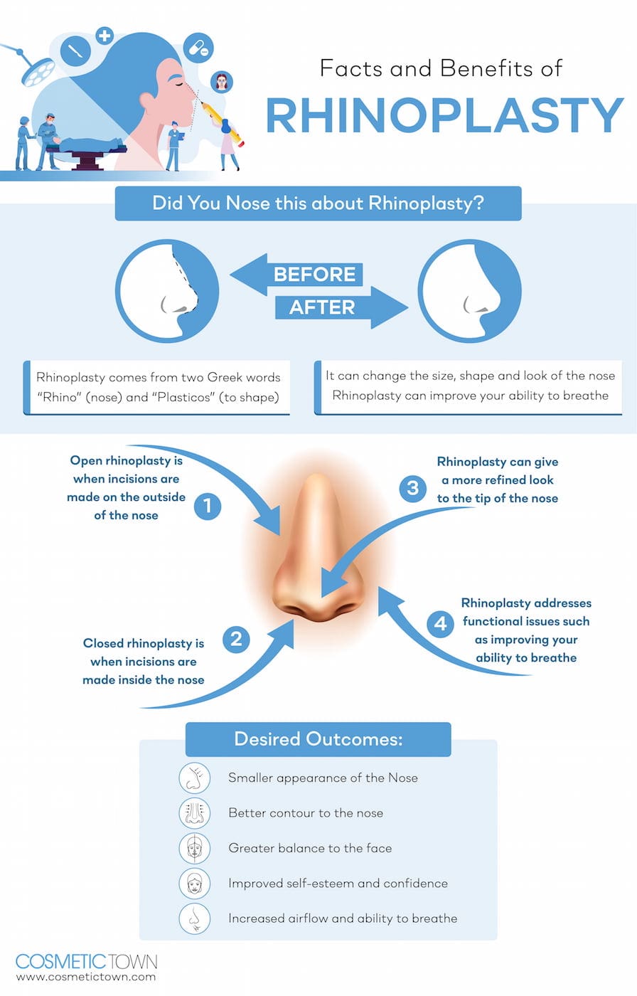 Dr. Trussler Nose Surgery