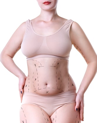 How Abdominoplasty Benefits Patient