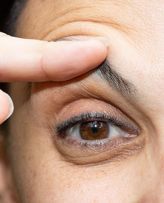 How Droopy Eyelid Impacts Vision