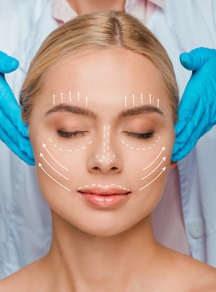 How Mini Facelift Works