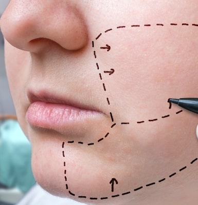 How to Reduce Jowls
