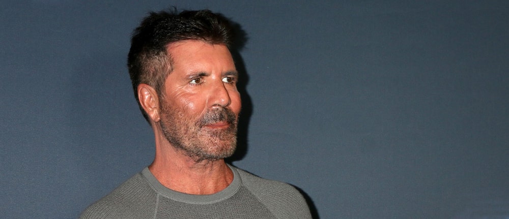 Did Simon Cowell have botox and fillers