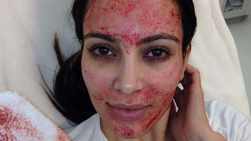 Kim Kardashian vampire facial lawsuit revealed