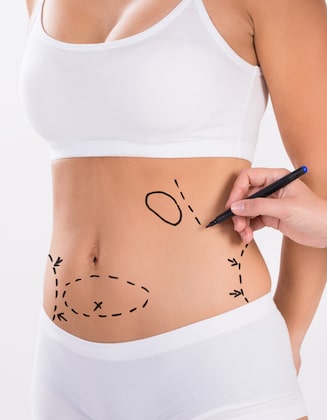 Liposuction Recovery Tips