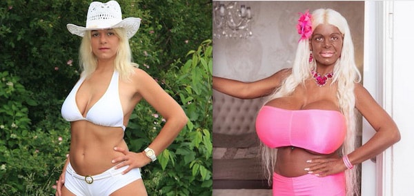 German Model Wants To Be an “Exotic Barbie”