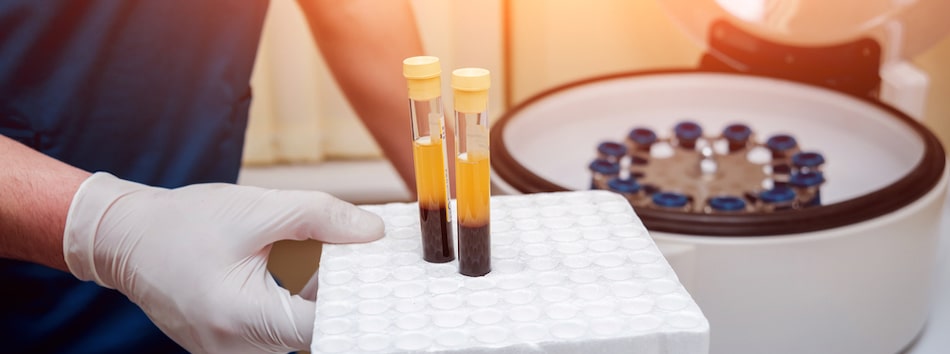 PRP Platelet Rich Plasma Treatment for the face