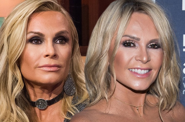 “Real Housewife” Opens Up About Plastic Surgery
