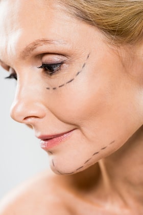 Things to know for cosmetic surgery
