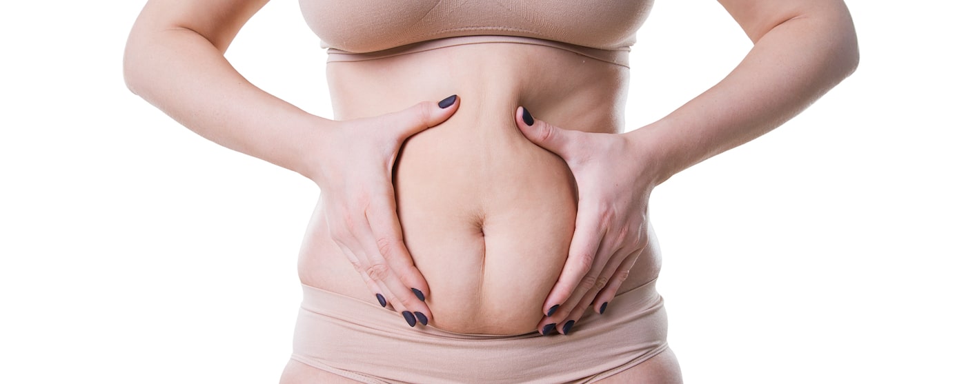 Tummy tuck - Secret surgery that is not seen on video calls