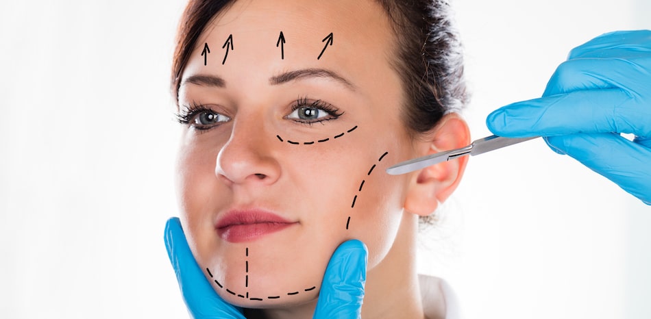 Things to Know Before a Facelift