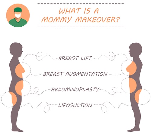 What is a Mommy makeover