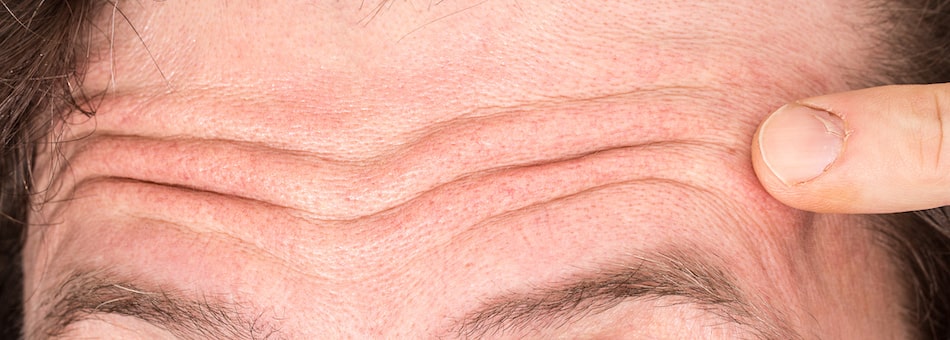 Forehead Reduction – What to Expect