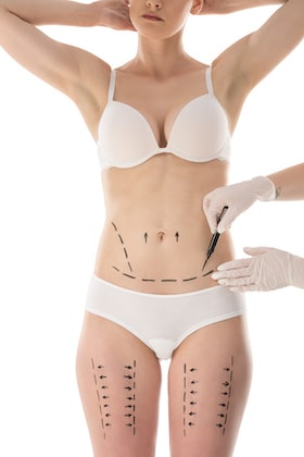 What to Keep in Mind for Cosmetic Surgery