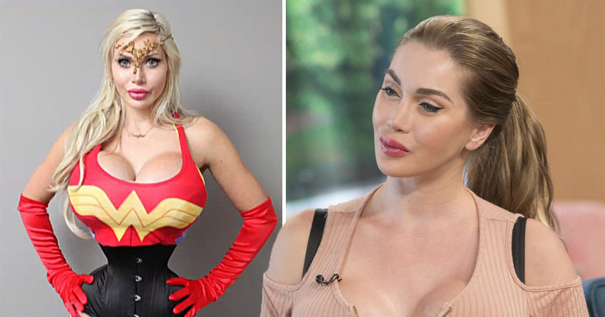 Viewers ‘disgusted’ by model Pixee Foxx who removed 6 ribs to look like Wonder Woman