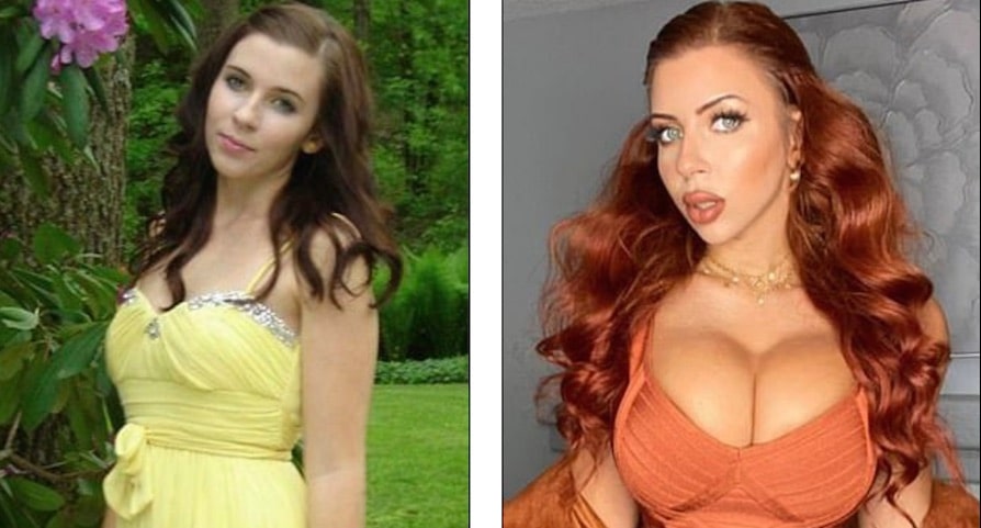 Amanda Martin makes millions after plastic surgery